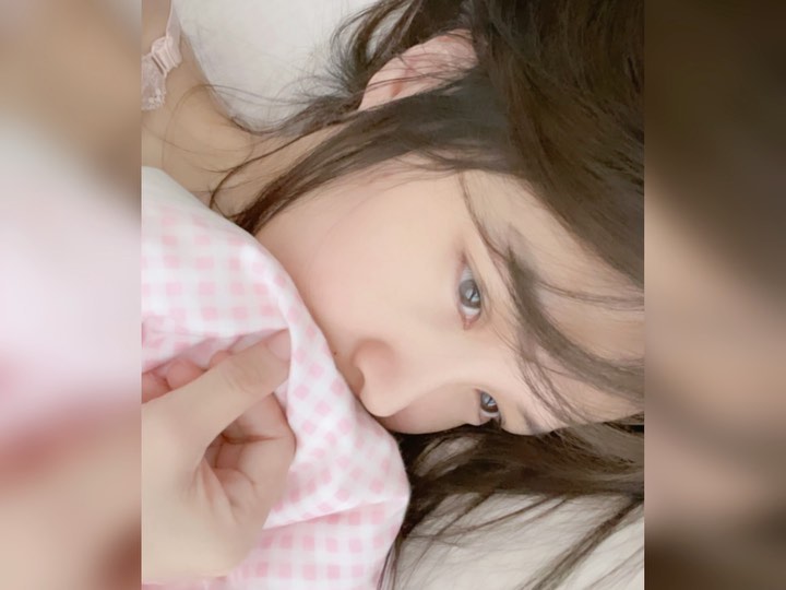  做了二氧化碳点阵激光N次的心得❤️