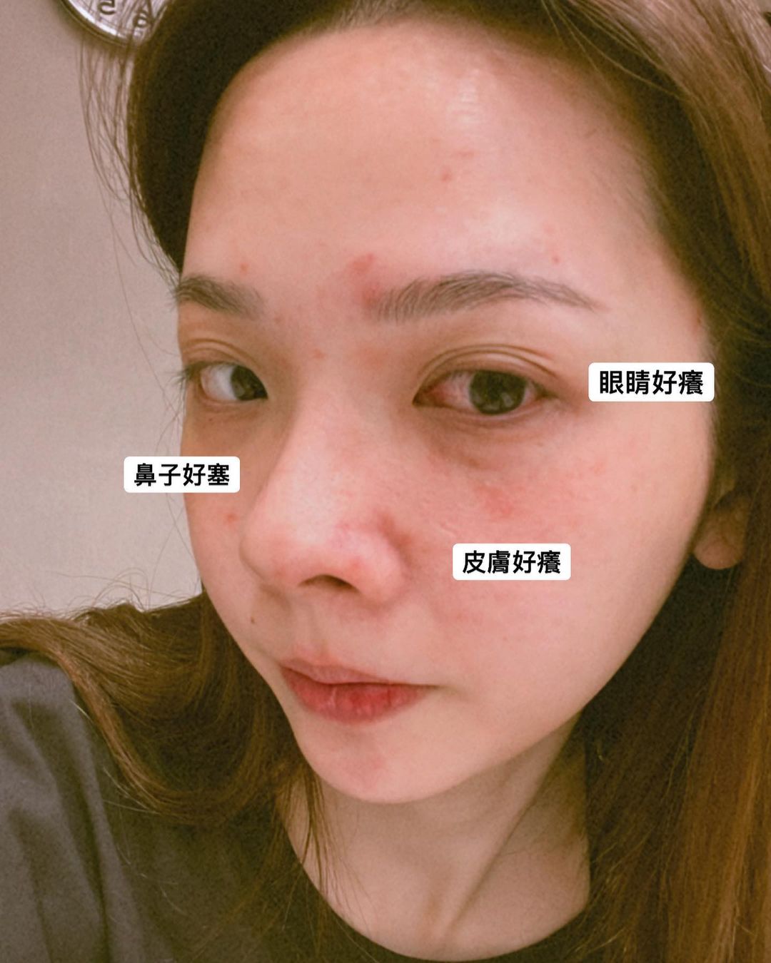  一張圖看懂過敏兒的悲哀
-
最近世界�...