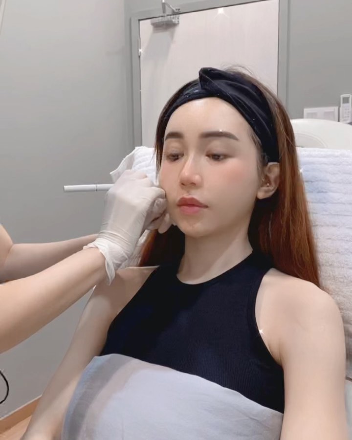  这绝对是我有史以来皮肤最好的moment