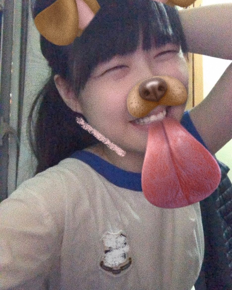  面骨係致命傷